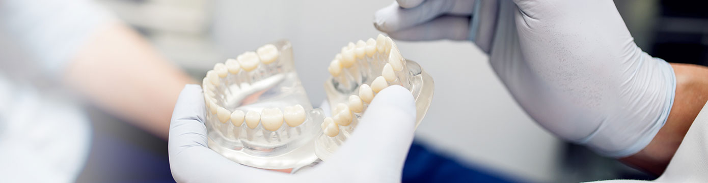 Prótesis dental en Hospitalet de Llobregat